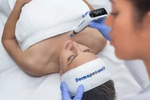 Proč si vybrat mikrojehličkování originálním Dermapenem?